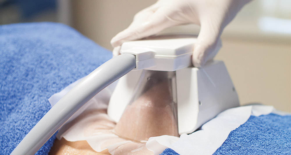 How Fat Freezing and HIFU Work Together? 2 Multiple Areas in One Session HIFU and Fat Freezing West Sussex