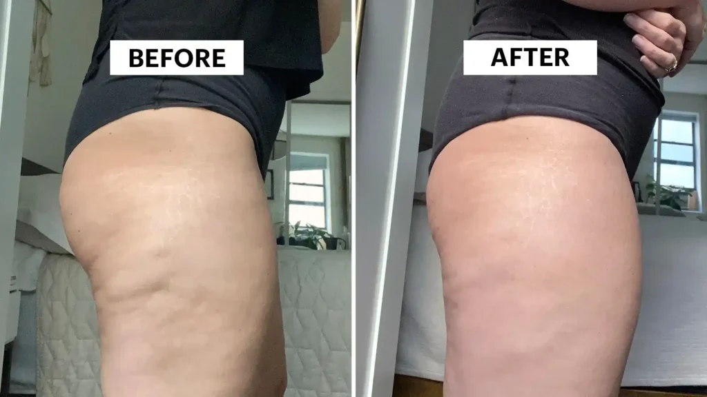Do Toning Exercise West Sussex Really Tackle Cellulite?