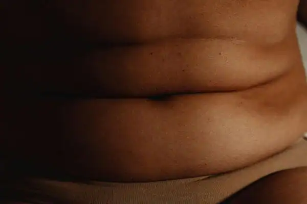 The Hidden Connection: How Stress Shapes Your Fitness and Body Composition 3 image of what stress can do on the stomach area and how Lipo 360 West Sussex can help to change your body shape.